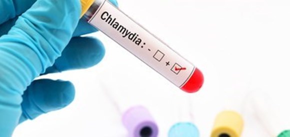 בדיקת כלמידיה (Chlamydia Diagnostic Test) - תמונה